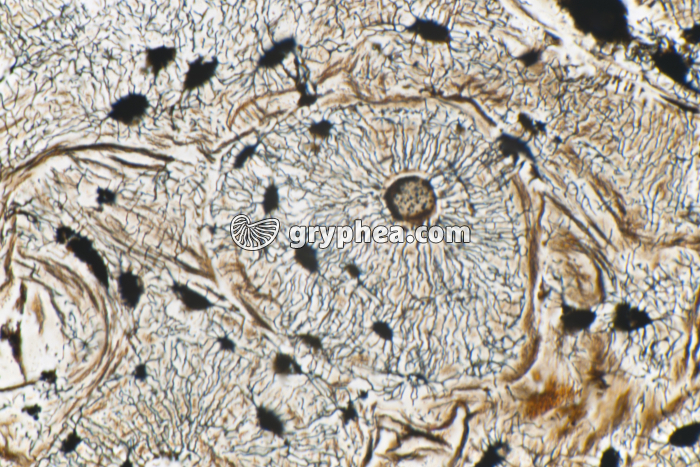 Os compact en CT - système de Havers x100 - gryphea.com